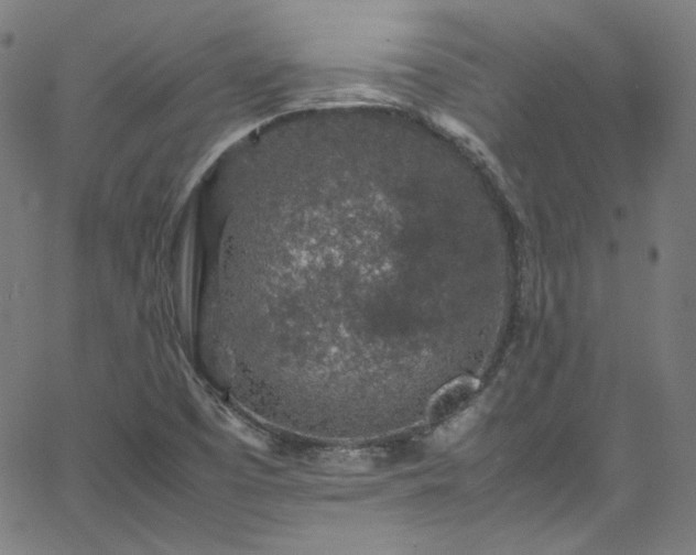 X0000065981457200603101410