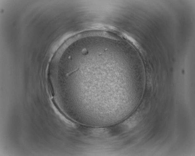 X0000065981479200603101410