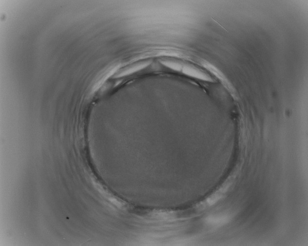 X0000065980977200603172111