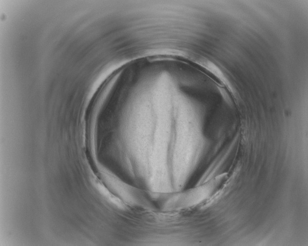 X0000065981140200603172108