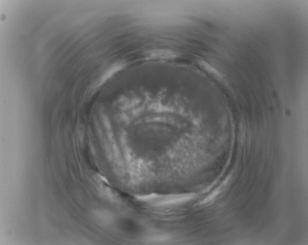 X0000065981401200603172103