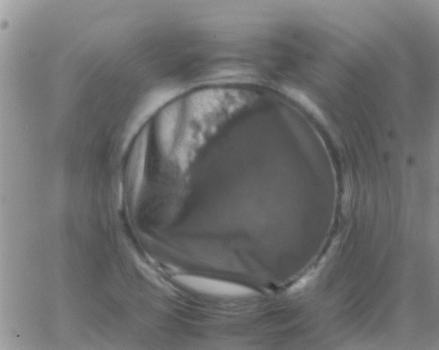 X0000065981413200603172103