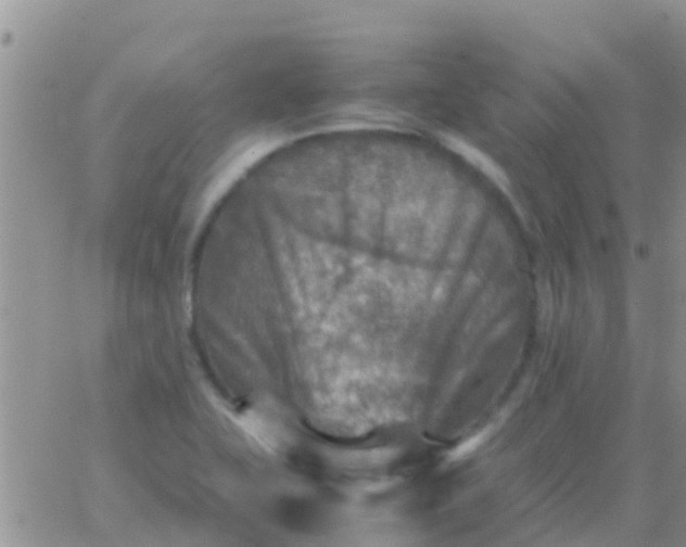 X0000065981415200603172104