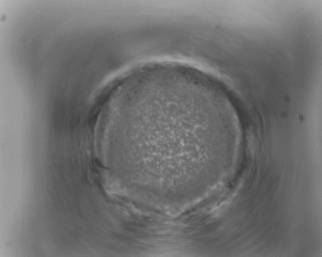 X0000065981494200603172102