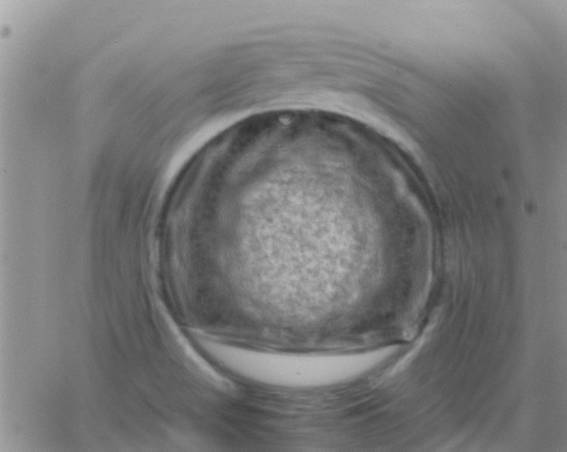 X0000065981517200603172102