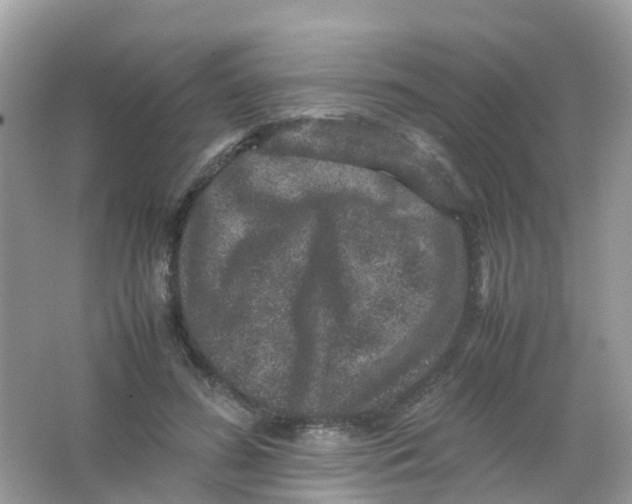 X0000065980596200603241941