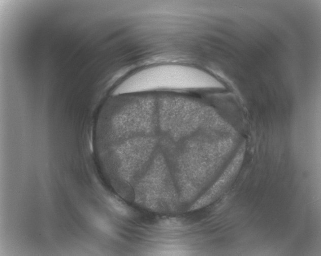 X0000065980062200603311915