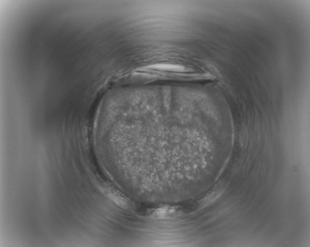 X0000065980366200603311911