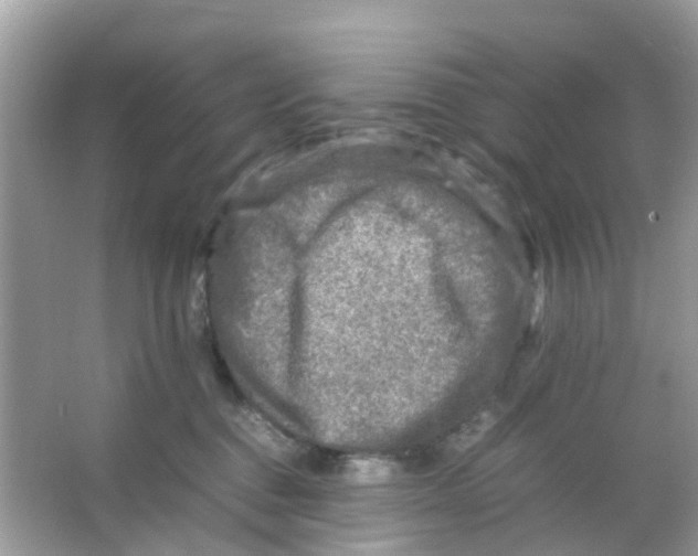 X0000065980376200603311911