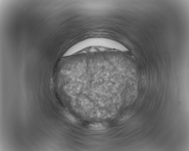 X0000065980381200603311911