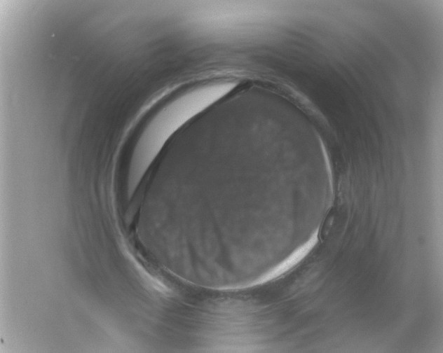 X0000065980722200603311904