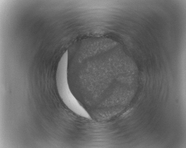 X0000065980818200603311902