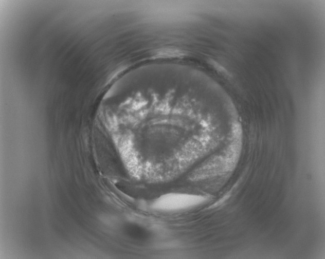 X0000065981401200603311852