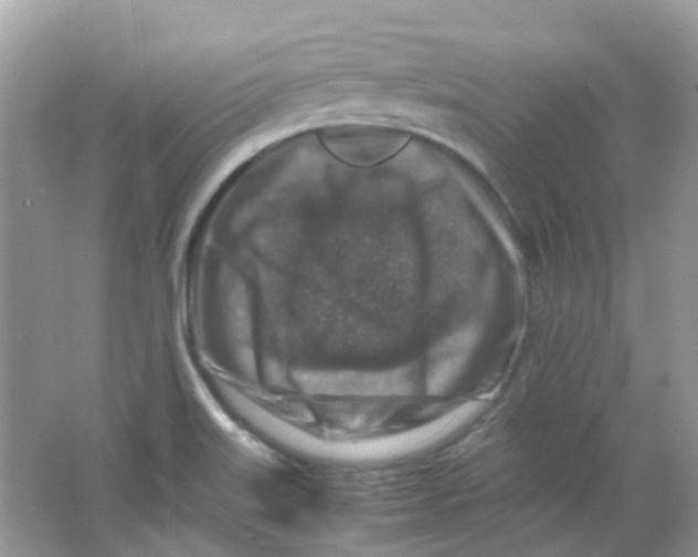 X0000065981515200603311851