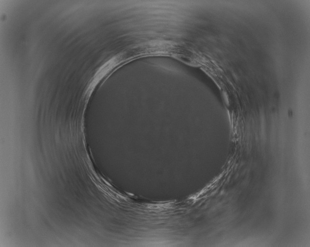 X0000065990099200603031206