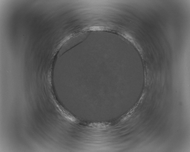 X0000065990297200603061304