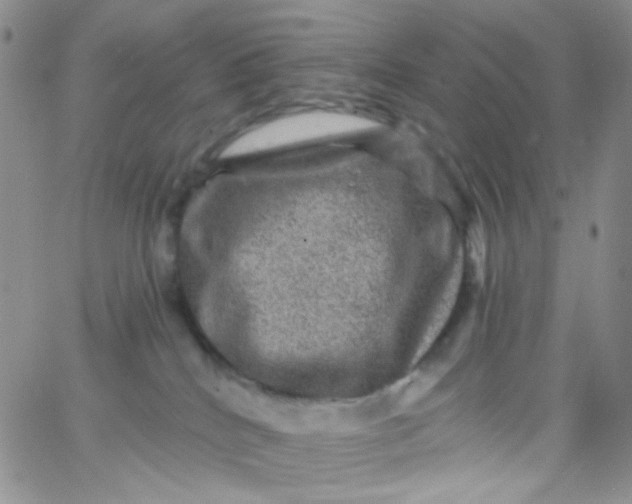 X0000065990040200603172151