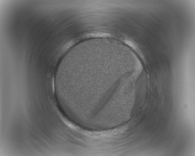 X0000065990013200603242017