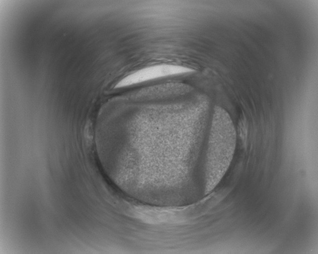 X0000065990040200603242017