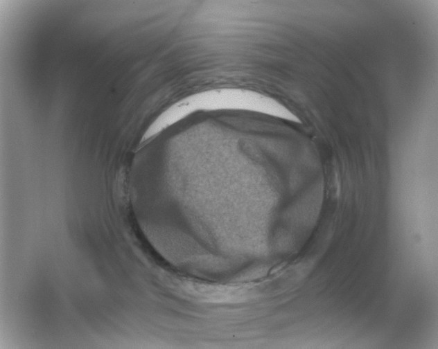 X0000065990044200603242017