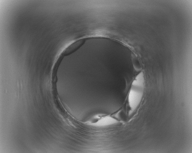 X0000065990200200603242014