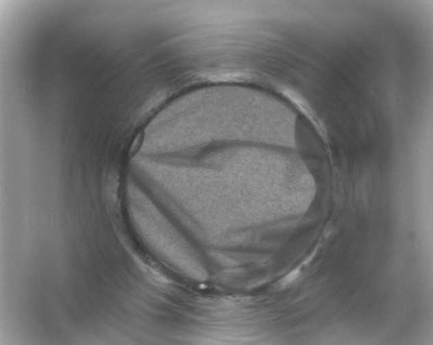 X0000065990201200603242014