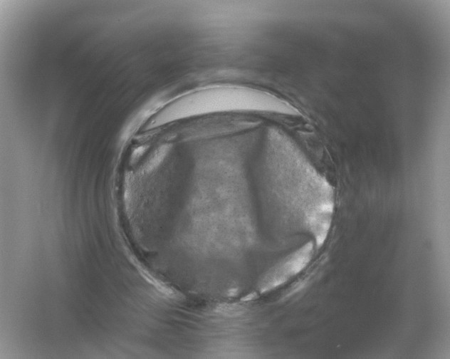 X0000065990341200603242011