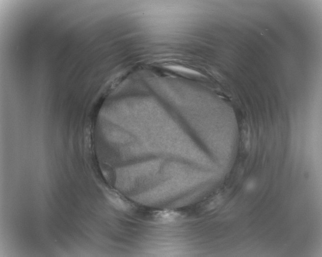X0000065990379200603242012