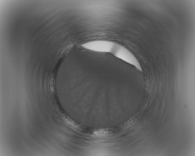 X0000065990470200603242010