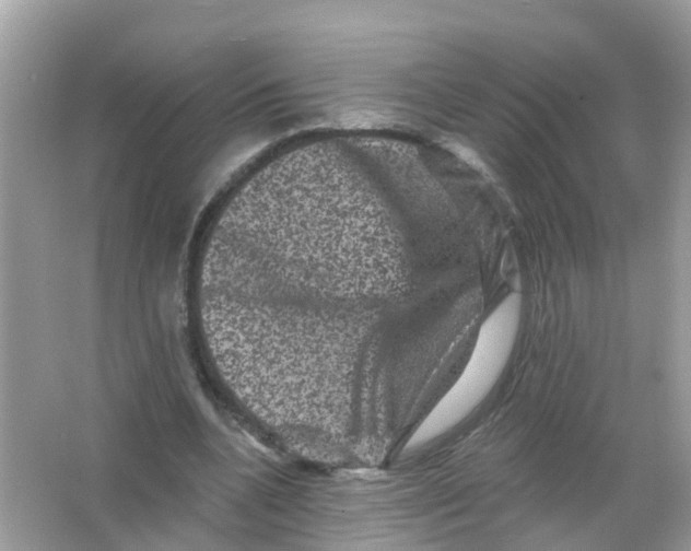 X0000065990536200603242008