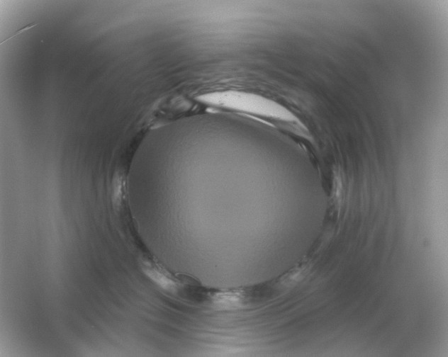 X0000065990574200603242008