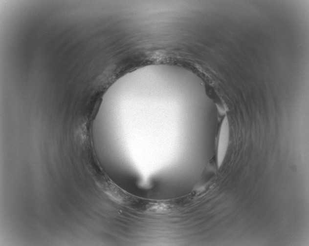 X0000065990611200603242007