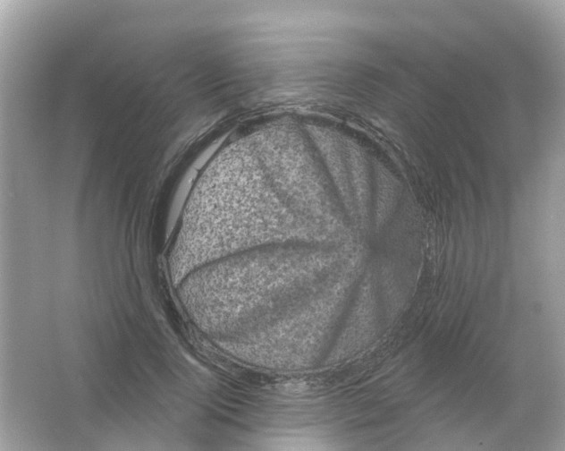 X0000065990740200603242005