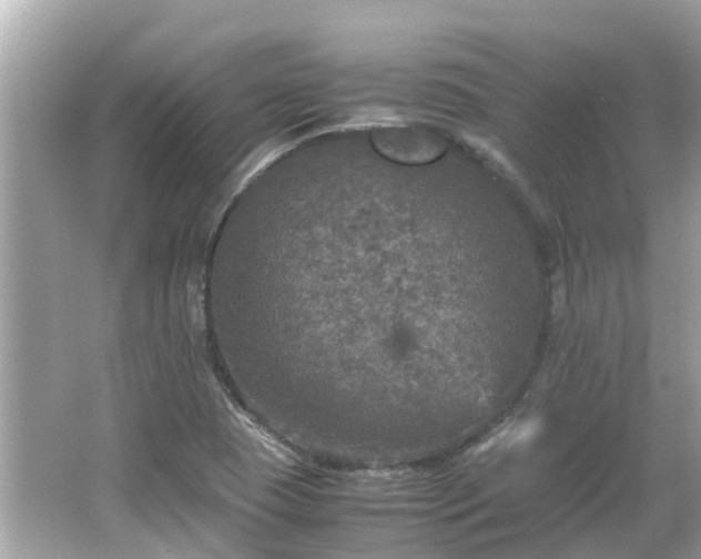 X0000066001409200603101518