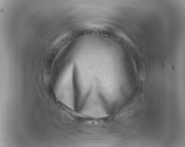 X0000066000869200603172203