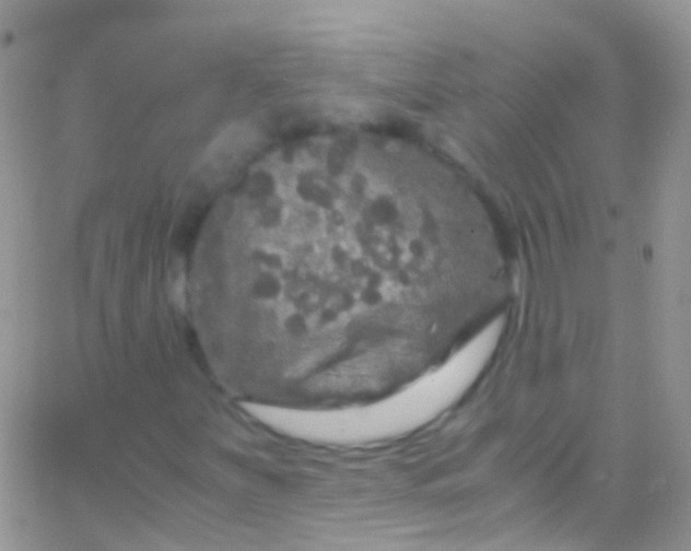 X0000066001251200603172156