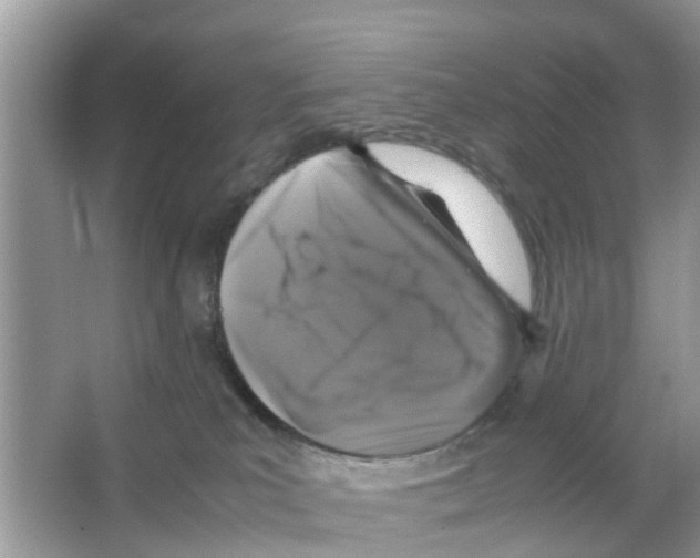 X0000066000039200603312008