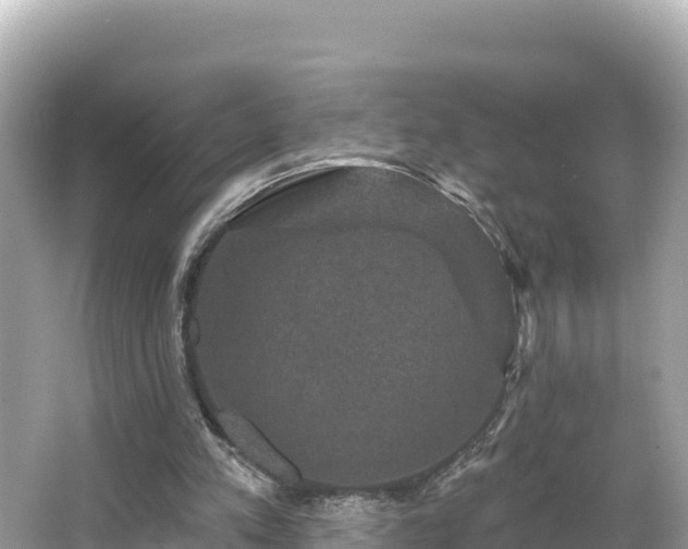 X0000066010197200603101605