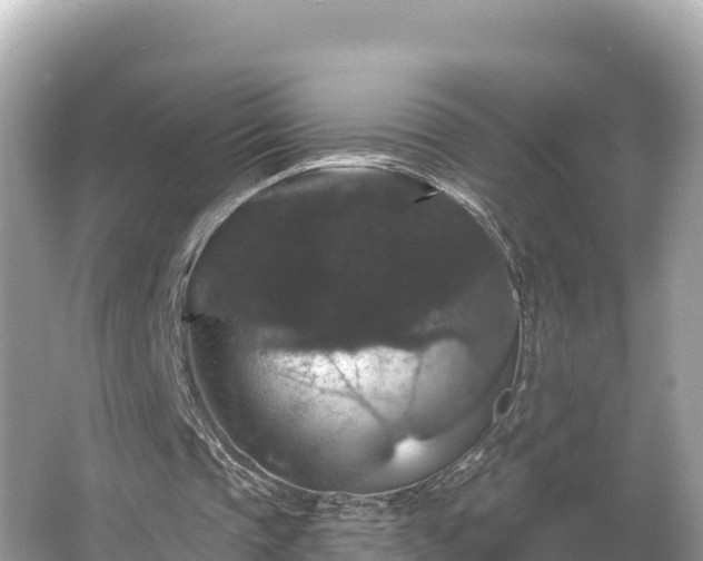 X0000066010337200603101602