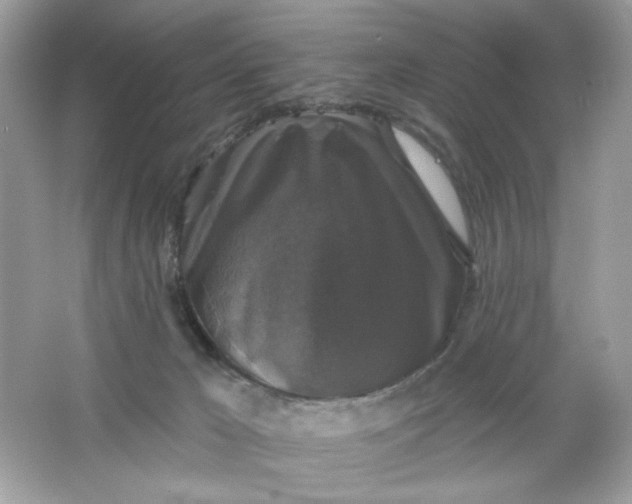 X0000066010029200603171517