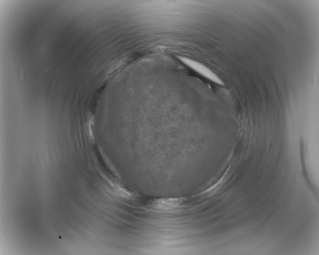 X0000066010094200603171517