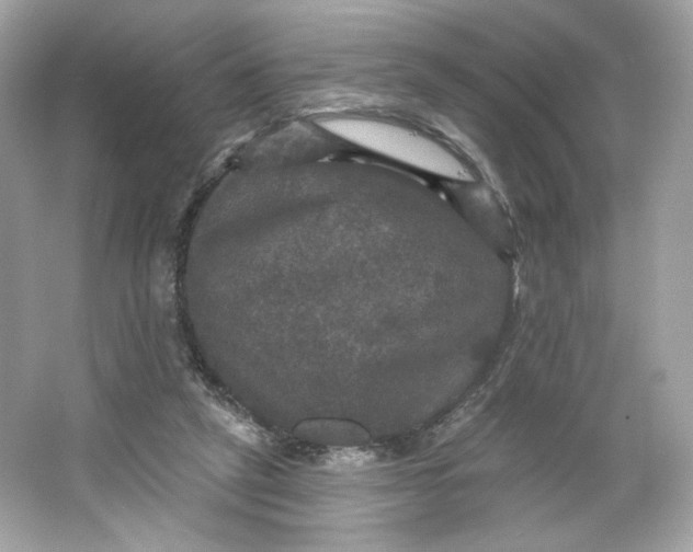 X0000066010257200603171513