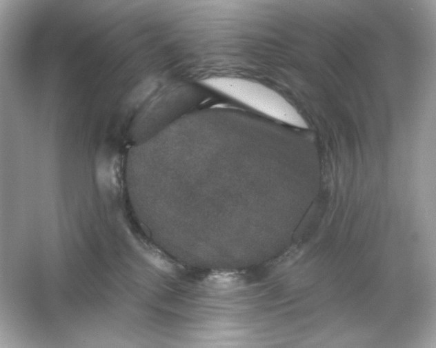 X0000066010280200603171514