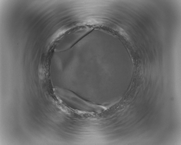 X0000066010920200603171502