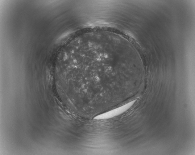 X0000066011063200603171500