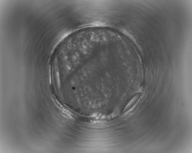 X0000066011171200603171458