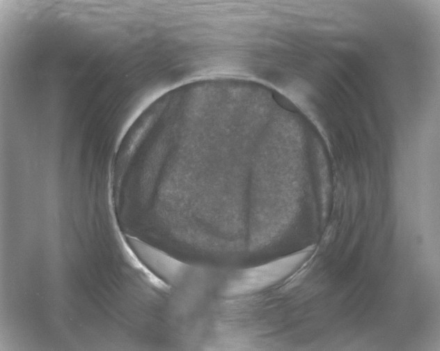 X0000066011390200603242046