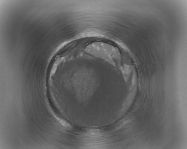 X0000066010438200603312027