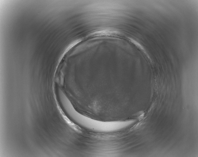 X0000066011042200603312018