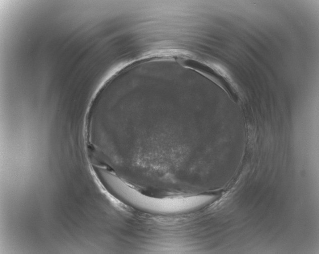 X0000066011046200603312018